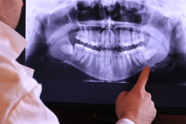 Best Emergency Root Canal Treatment in Enola, PA